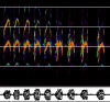 Sonogramm (80 KB)