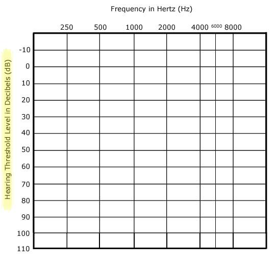 How to read an audiogram the basics