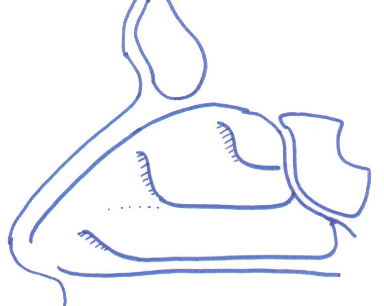 "Inside view" of the lateral nasal wall.&nbsp; The turbinates are displayed.