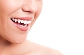 icing elite teeth whitening system review