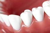 5 minute teeth whitening cvs