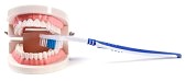 home teeth whitening laser kit