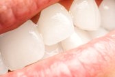 boston teeth whitening