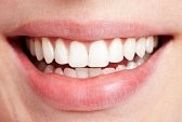 teeth whitening saint louis